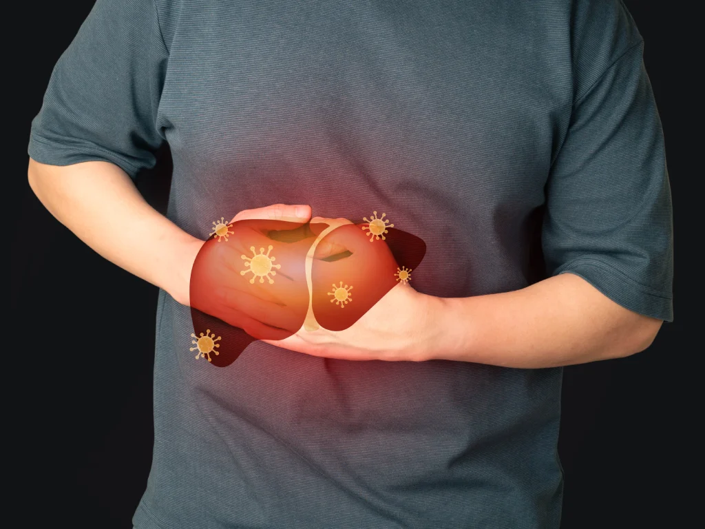 Infeksi hati akibat hepatitis