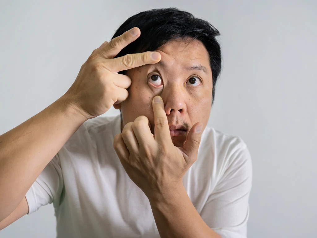 早晨醒来眼皮肿胀