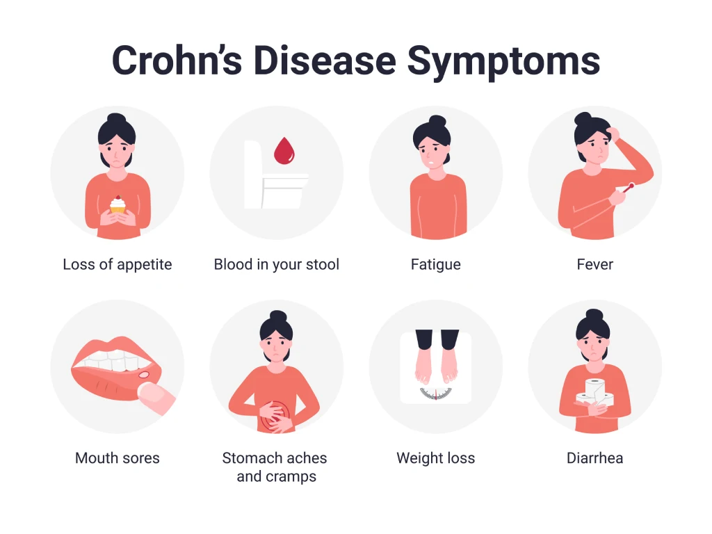 Gejala Penyakit Crohn