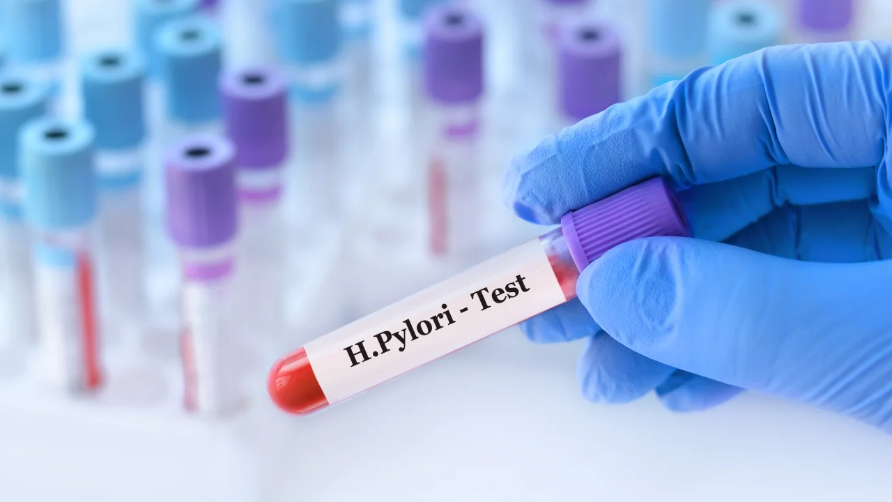 Tes H. pylori di Singapura