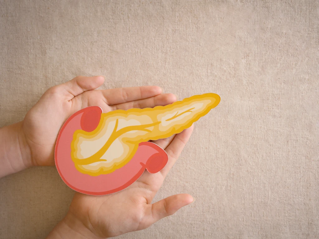 Pancreatic Cysts Illustration