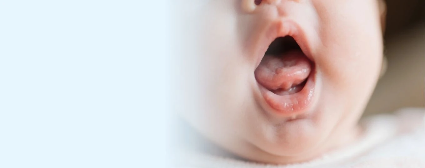 Dr Cheong Yee Ling, Tongue Tie Assessment in Singapore
