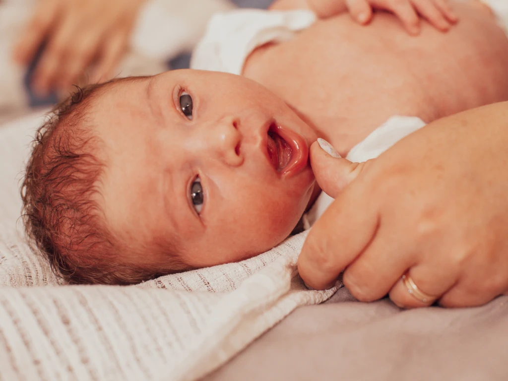 Tongue Tie in a Newborn Baby